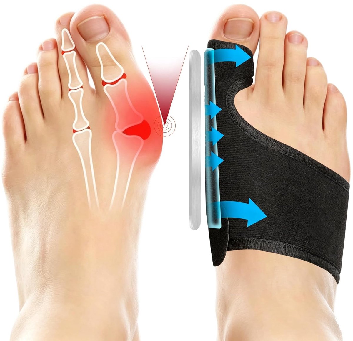 1 paar hallux valgus corrector herbruikbare teenspreider incl
