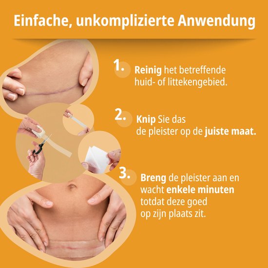 Stappenplan: reinigen, op maat knippen en de siliconen pleister aanbrengen.