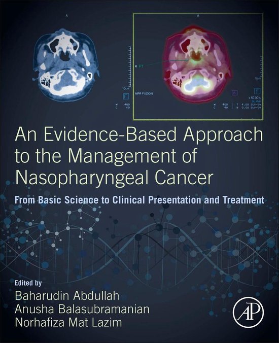 An Evidence-Based Approach to the Management of Nasopharynge ... - cover