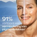Vóór en na foto van een gezicht, toont vermindering van pigmentvlekken met 91%.