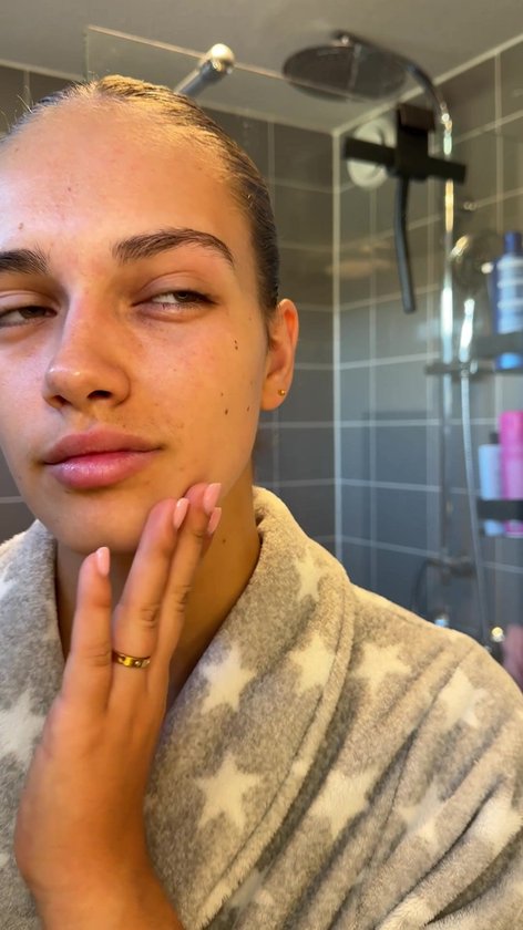 Hydrocolloïde Pimple Patch (432 STUKS) met Tea Tree Olie – Acne Patches – Puisten Verwijderaar – Pukkel Pleisters