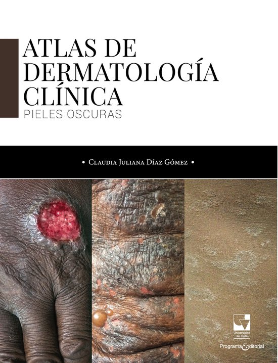 Salud - Atlas de dermatología clínica - cover