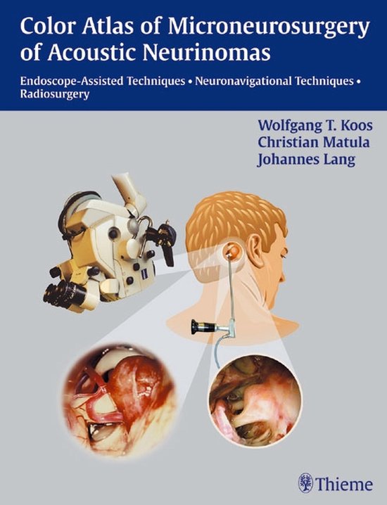 Color Atlas of Microsurgery of Acoustic Neurinomas - cover