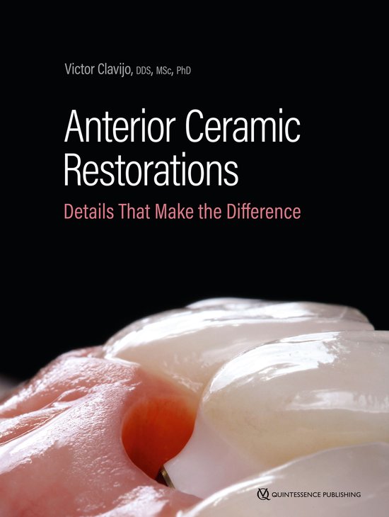 Anterior Ceramic Restorations - cover