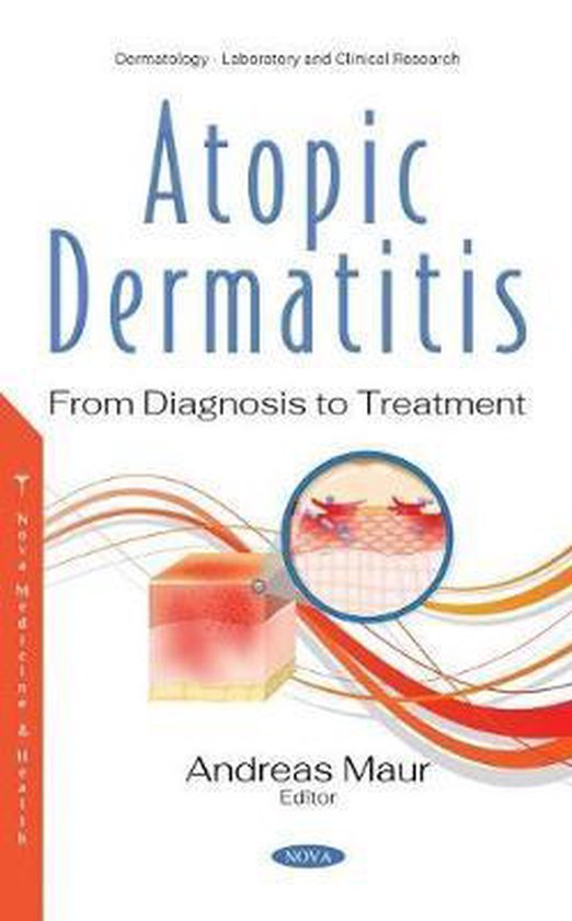 Atopic Dermatitis 9781536185201 Boeken