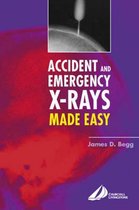 Accident & Emergency X Rays Made Easy