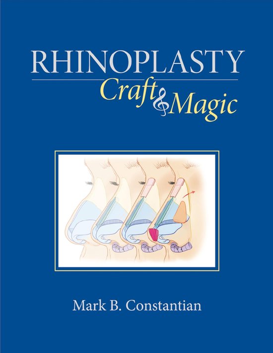 Rhinoplasty - cover
