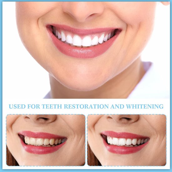 Glimlach met witte tanden, met voor-en-na foto's van tandenrestauratie en whitening.