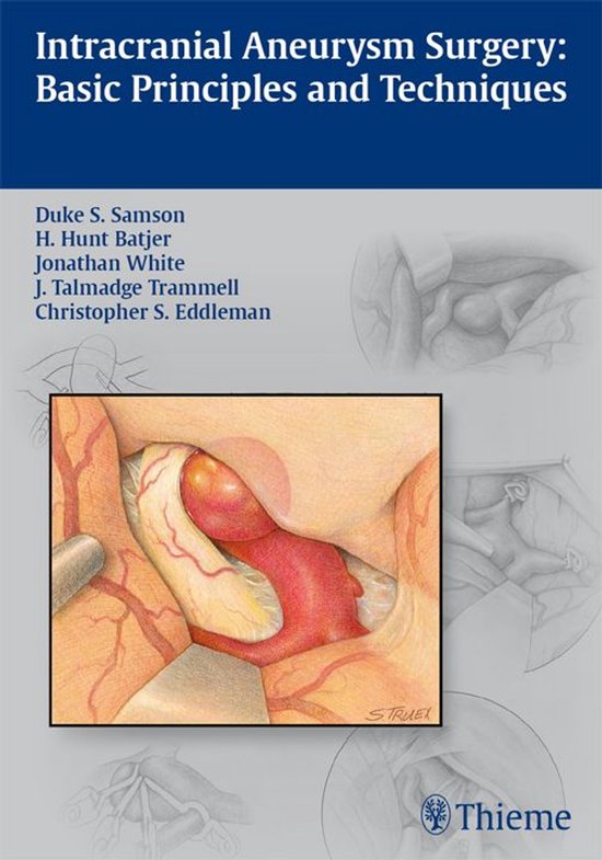 Intracranial Aneurysm Surgery - cover
