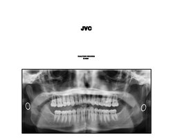 JVC