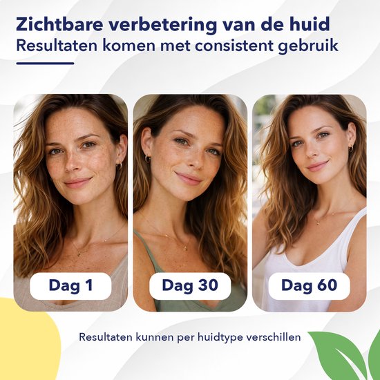 Lemon Turmeric & Kojic Acid Soap – Kurkuma Zeep 100% - Pigmentvlekken Verwijderen – Darkspot Remover