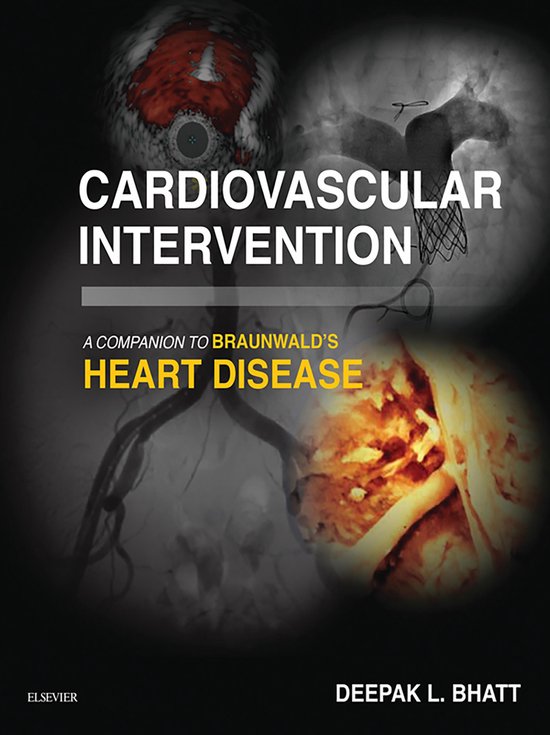 Companion to Braunwald's Heart Disease - Cardiovascular Inte ... - cover