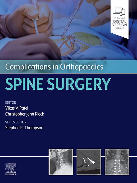 Complications in Orthopaedics - Complications in Orthopaedic ... - cover