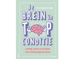 Je brein in topconditie
