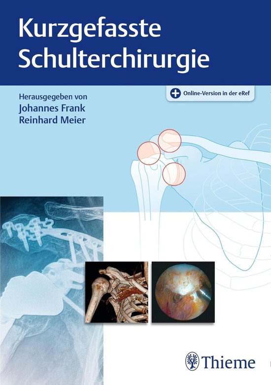 Kurzgefasste Schulterchirurgie - cover