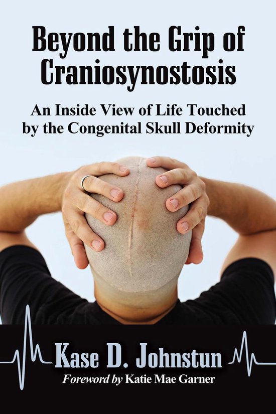 Beyond the Grip of Craniosynostosis - cover