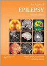 An Atlas Of Epilepsy
