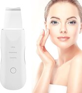 Essentials® Gezichtsreiniger – Ultrasone Gezichtsreiniger- Mee Eters Verwijderen - Blackhead Remover - Puisten Verwijderaar - Mee Eter Verwijderaar - Gezichtsreiniger Elektrisch – Huidverzorg