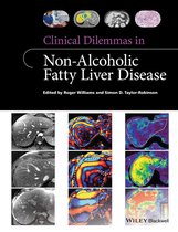 Clinical Dilemmas (UK) - Clinical Dilemmas in Non-Alcoholic Fatty Liver Disease