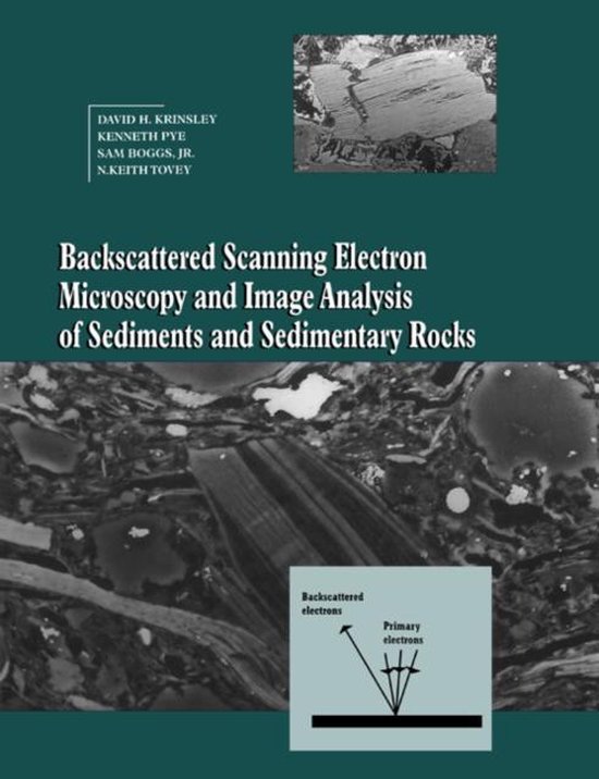 Backscattered Scanning Electron Microscopy And Image Analysis of ...