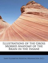 Illustrations of the Gross Morbid Anatomy of the Brain in the Insane