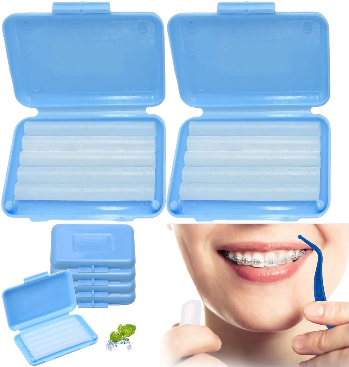 Solidchoice - Orthodontische Wax voor Beugels en Draad