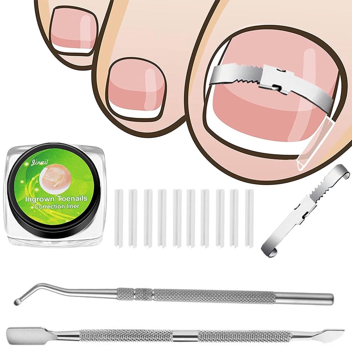 Elzusha - Corrector voor Ingegroeide Teennagels van Roestvrij Staal