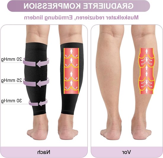Compressiekousen voor Mannen en Vrouwen - 20-30 mmHg, Medische Steunkousen voor Thrombose en Bloedcirculatie, Gegradueerde Ondersteuning, 2 Paar — afbeelding 2