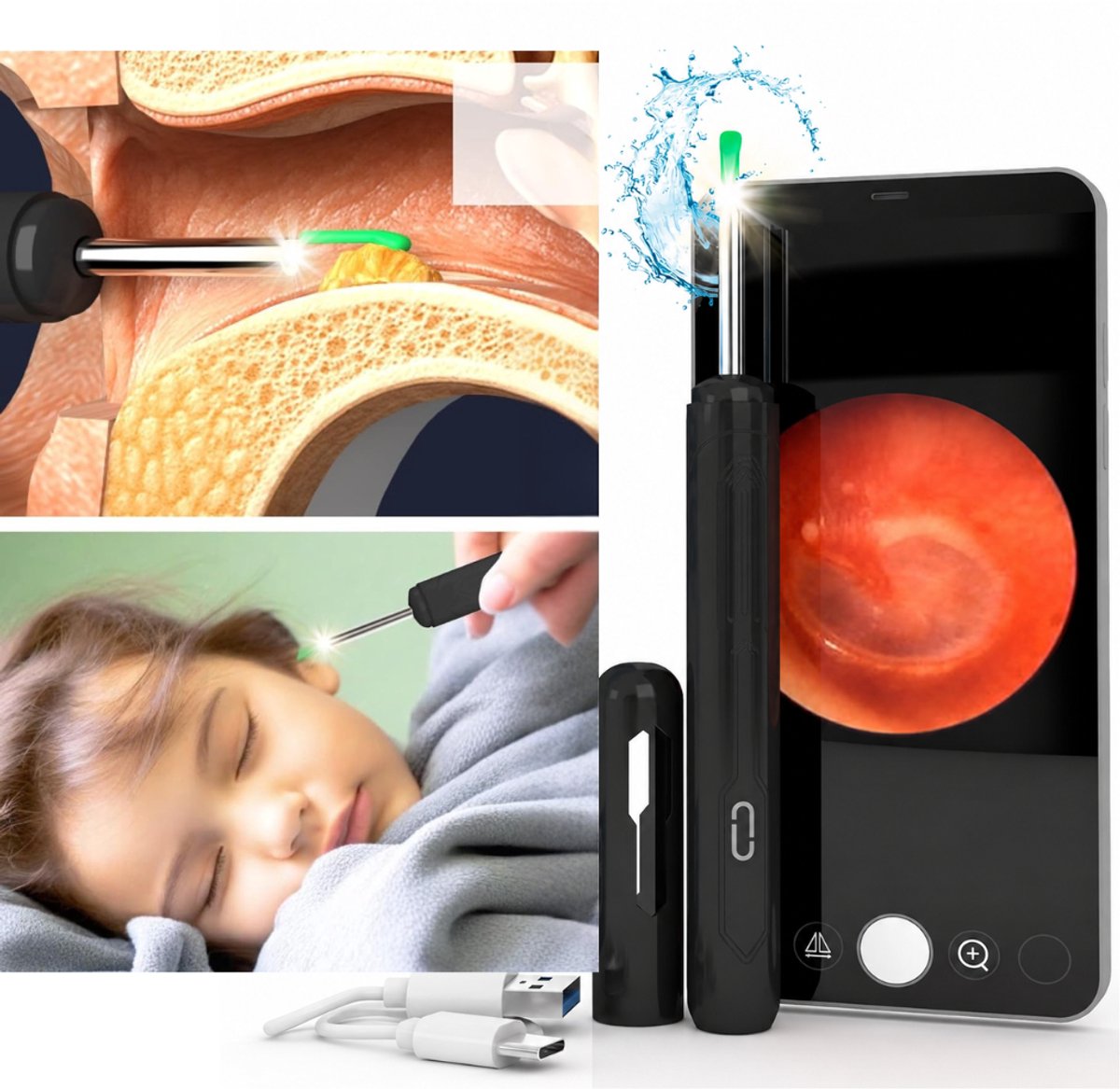 CLGP® Oor Reiniger - Otoscoop Camera - Oor Inspectie - HD IPS Scherm -Zwart