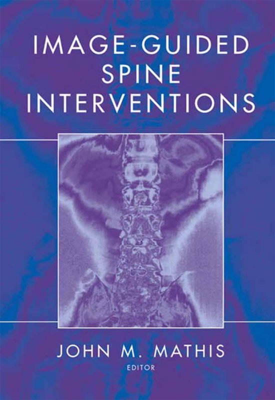 Image-Guided Spine Interventions - cover