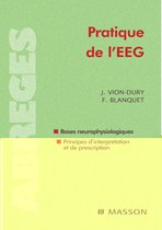 Pratique de l'EEG