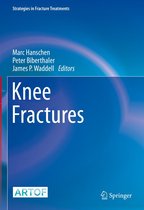 Strategies in Fracture Treatments - Knee Fractures