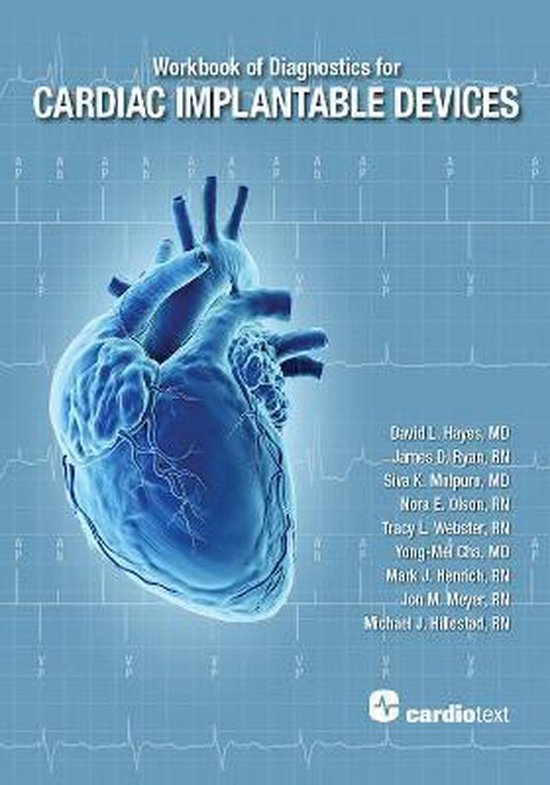 Foto: Workbook of diagnostics for cardiac implantable devices