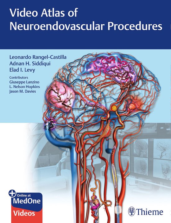 Video Atlas of Neuroendovascular Procedures - cover