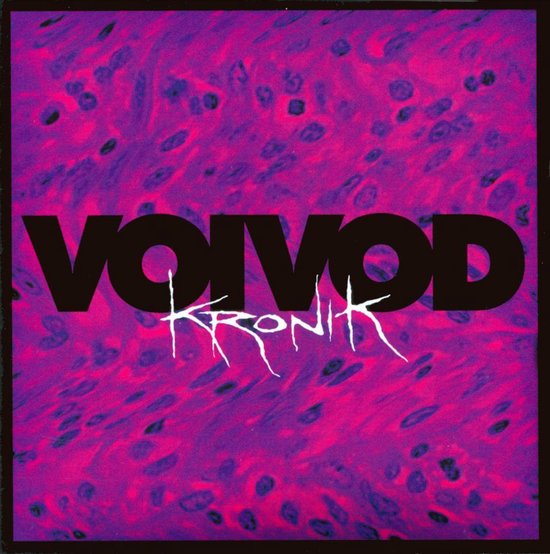 Kronik