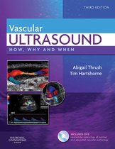 How, Why and When - Vascular Ultrasound