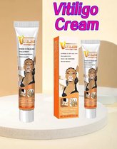 2 stuks zeer effectieve vitiligo en psoriasis anti bacteriële creme helpt vitiligo te verminderen / verwijderen. Anti vlekken creme