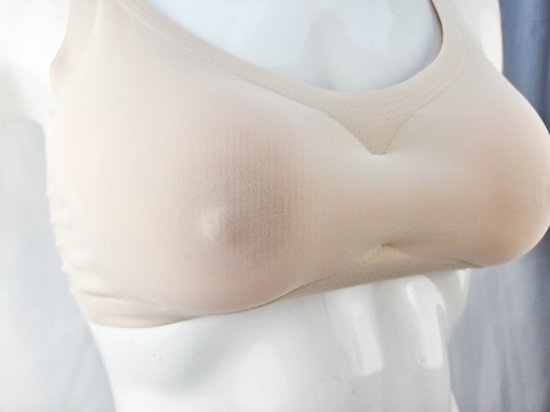 MTF borstcorrectie - Welkom | De Baronie, uw privé kliniek voor Plastische-, esthetische chirurgie en Esthetische geneeskunde by Dr. Peter Myny