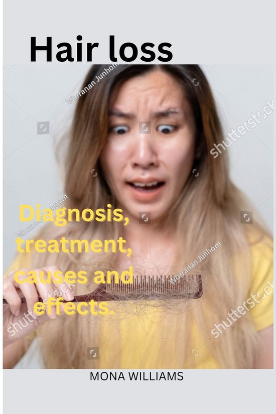 Hair loss (ebook), Mona Williams 1230005845194 Boeken bol