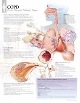 COPD (Chronic Obstructive Pulmonary Disease) Paper Poster