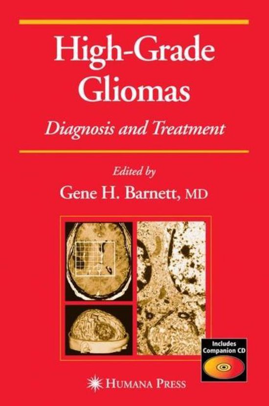 High-Grade Gliomas - cover
