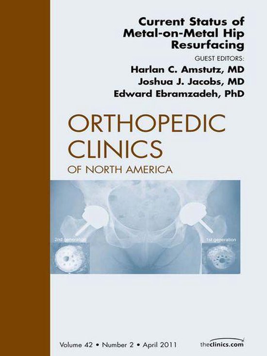Current Status Of Metal-On-Metal Hip Resurfacing, An Issue O ... - cover