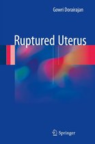 Ruptured Uterus