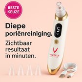Vivefly Healthcare Blackhead Remover Aurelia - Poriënreinigers - Mee-eter Verwijderaar - Gezichtsreinigingsapparaat - Gezichtsverzorging - Huidverzorging - Gezichtsmasker - Acne Behandeling