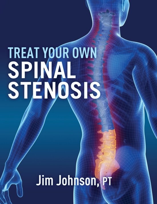 Treat Your Own Spinal Stenosis - cover