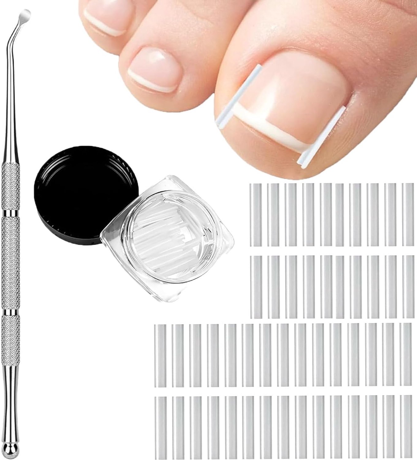 Correctieset voor ingegroeide nagels, 50 pijnloze gladmakende strips met nagellift, voor ingegroeide nagels, pijnloze correctie voor mannen en vrouwen