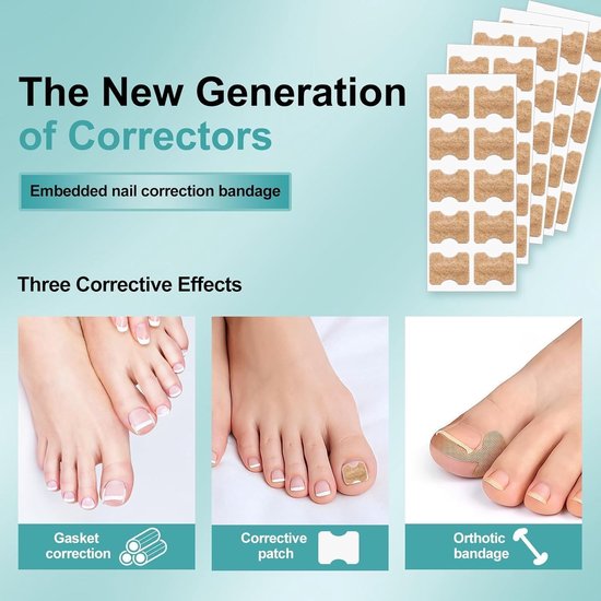 Set voor het corrigeren van ingegroeide teennagels met nagelsteun en pleisters voor grote tenen — afbeelding 2