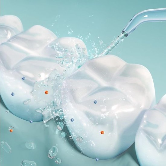 6 stuks Spare Nozzle High Pressure Dental Jet voor Waterpik, Nozzle Dental Appliance Compatibel met Waterpik Water Flosser Wf02/03ec Wp-100/108/112/250ec Wp-450/462/560/562ec Wp-563/565/660 — afbeelding 4
