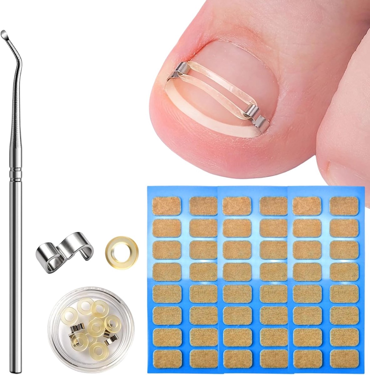 Set voor de ingegroeide teennagels, professionele corrector voor ingegroeide teennagels