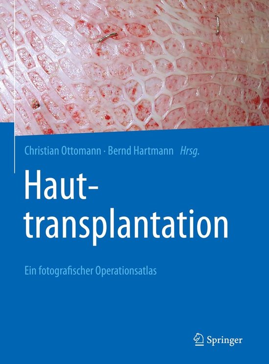 Hauttransplantation - cover